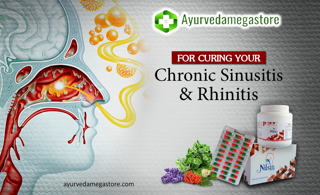 SG Phytopharma Nilsin Capsule For Curing Your Chronic Sinusitis And Rhinitis